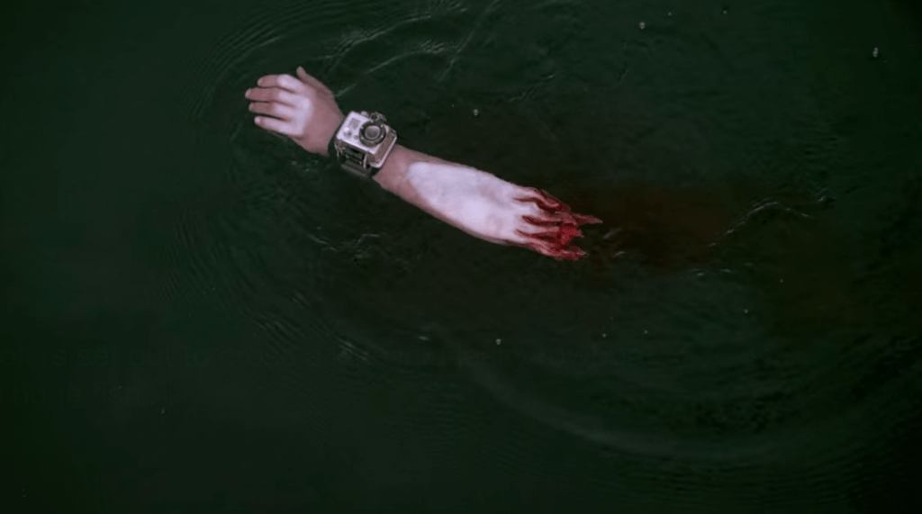 The GoPro guy's severed arm!