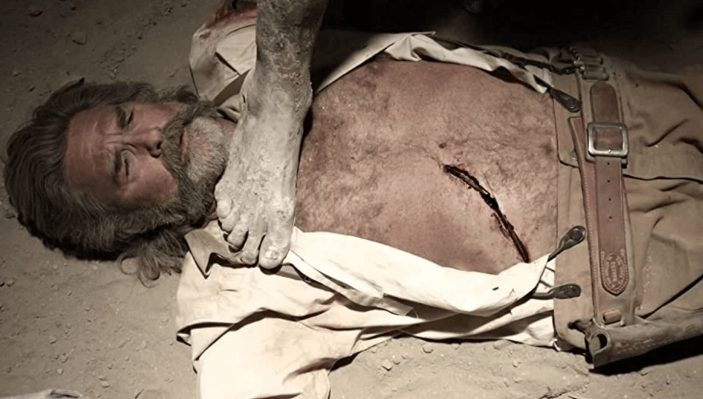 Sheriff Hunt has his belly sliced into...