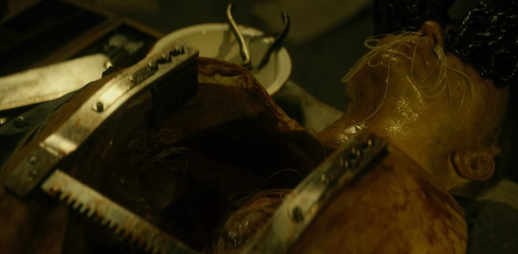 An autopsy scene involving a worm-infested corpse