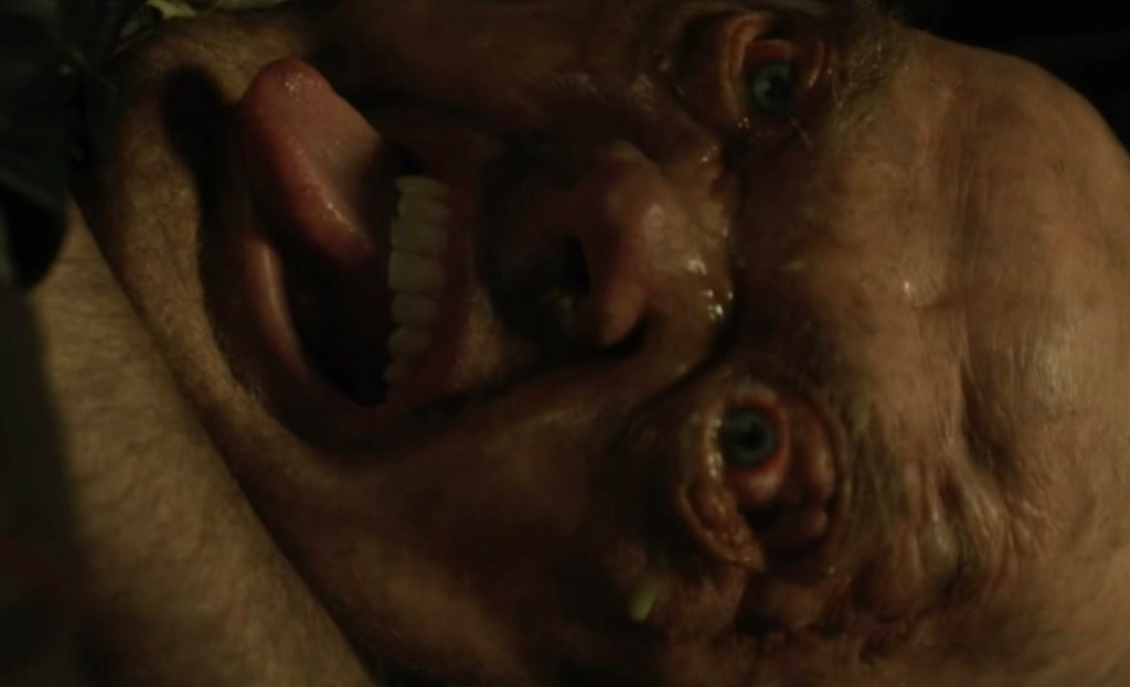 Swollen-faced victim!