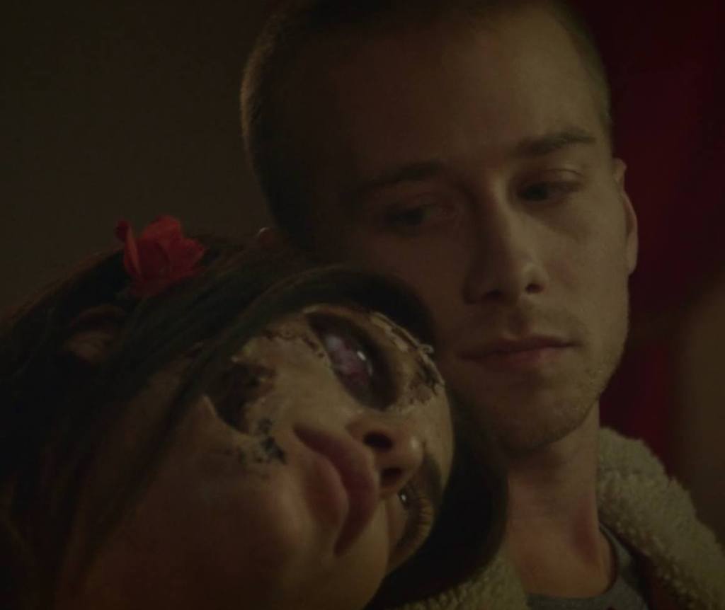 Louise during a scabby-faced phase