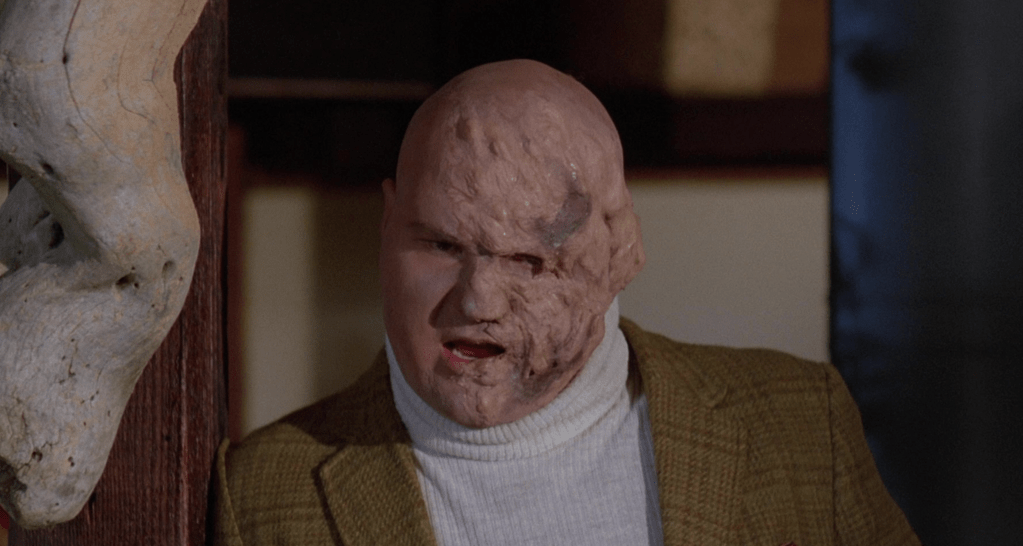 Radiation can be bad for you