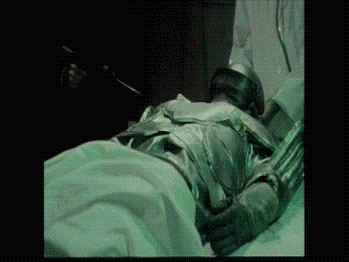 We can rebuild him! We have the technology!