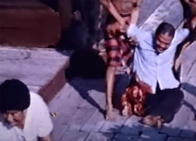 A dude has his leg bitten off