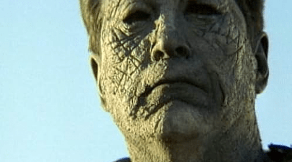 He needs to use moisturiser!