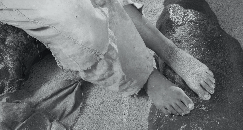 Hayat's left foot has fish scales growing on it